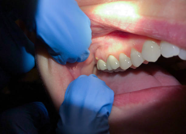 Best Emergency Treatment for Jaw Pain or Injury in Pasadena, TX